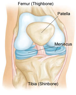 What is a Meniscus Tear